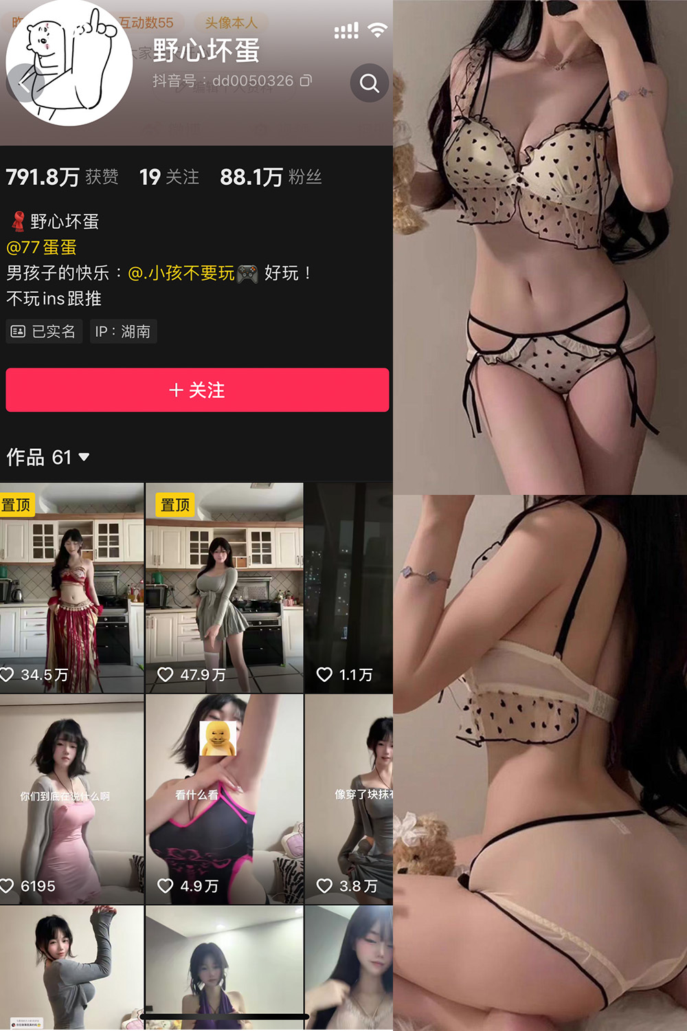 抖音 野心坏蛋 微密圈 NO.007期 【13P】最新至:2025.1.12